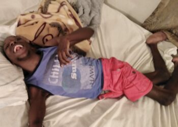 Taku, a Cerebral Palsy patient, needs financial support
