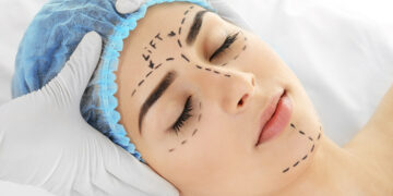Crucial factors to consider before having a cosmetic surgery, by Stanley Ugagbe