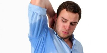 Managing Excessive Sweating: Practical Tips for a Drier, More Comfortable Life