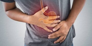 Gentle on the Stomach: Foods to Avoid for Gastric Health