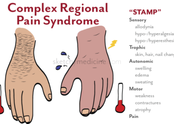 Redefining Pain: A Closer Look at Complex Regional Pain Syndrome