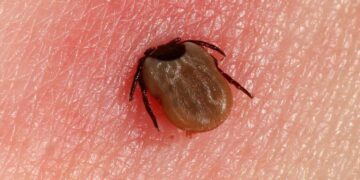 Canadian Patients Travel to Mexico for alternative Lyme disease treatments