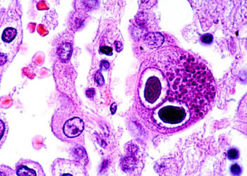 3 health facts that might surprise you