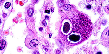 3 health facts that might surprise you