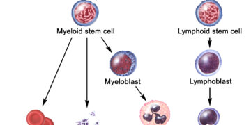 What you should know about organ and stem cell transplants